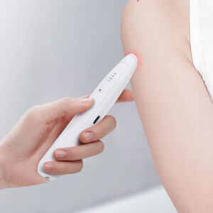 Electric Bite Itch Healer with 4 Class Temperature Heating Pen Rechargeable Safe Insect Bite Healer for Adult and Children
